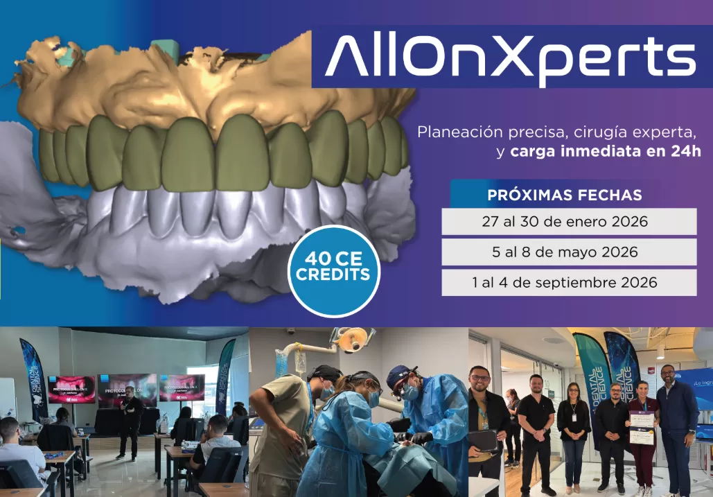Imagen del Curso AllOnXperts